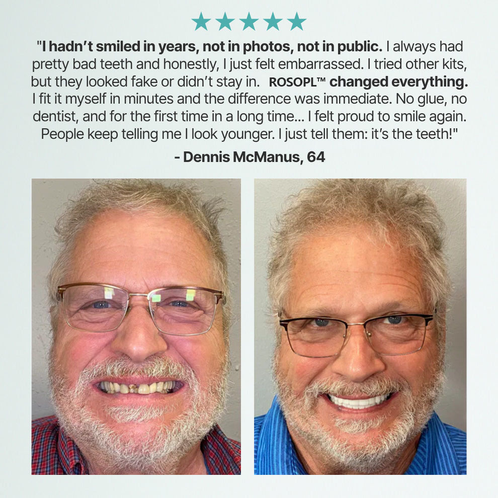 NEYEROS™ Advanced Functional Dentures — Get Your Smile Back With A Secure & Comfortable Fit
