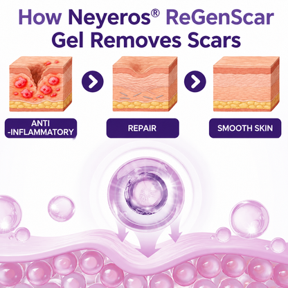 Neyeros® ReGenScar Stem Cell Scar Gel