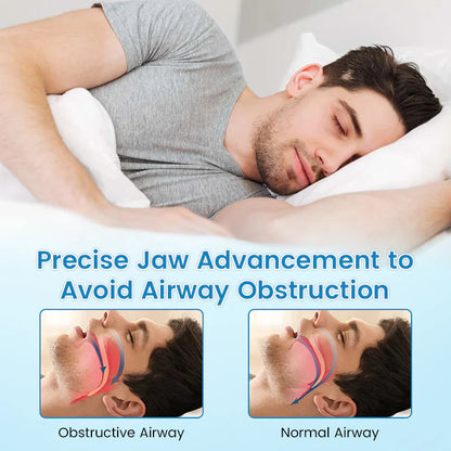 🔥[Official Brand Store] NEYEROS™ Adjustable Anti-Snoring Mouthpiece  Universal Size
