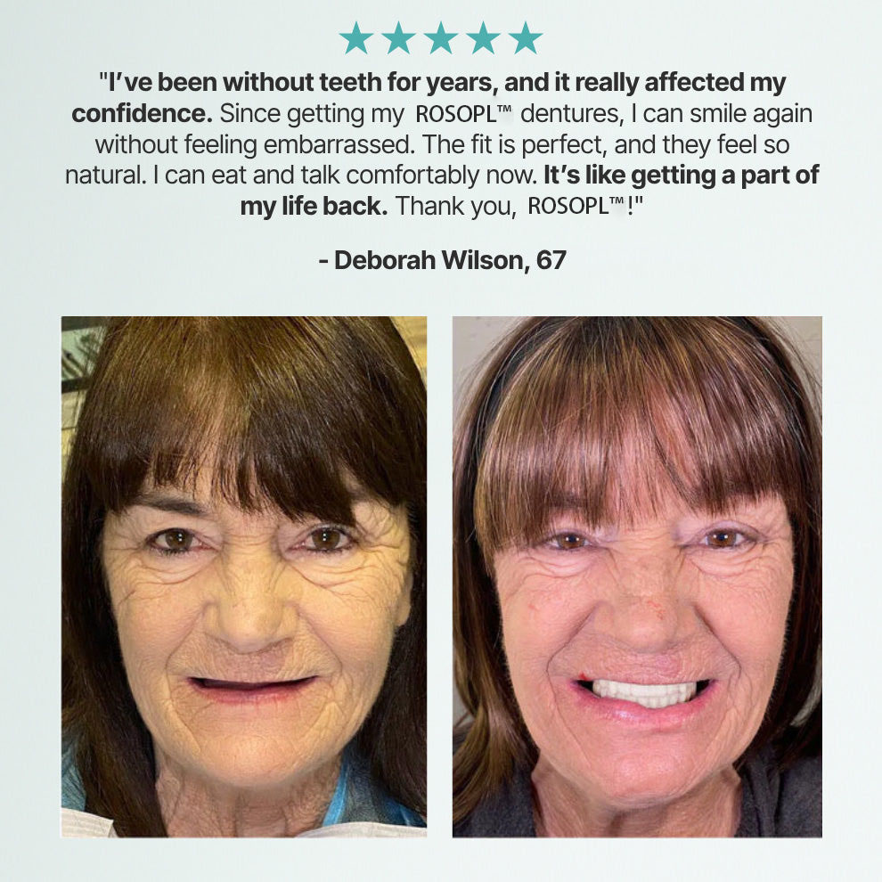NEYEROS™ Advanced Functional Dentures — Get Your Smile Back With A Secure & Comfortable Fit