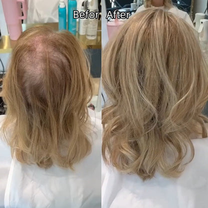 🔥Last Day:60% Off🌷2026 New Lightweight & Breathable Wavy Hair Topper